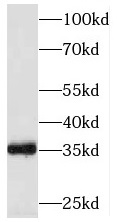 SESTD1 antibody|SESTD1抗体 FNab0