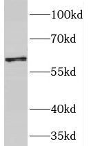 PGM1 antibody|PGM1抗体 FNab06359