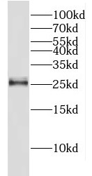 METTL21A antibody|METTL21A抗体