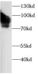 ENG antibody|ENG抗体 FNab10759