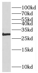 PARP11 antibody|PARP11抗体