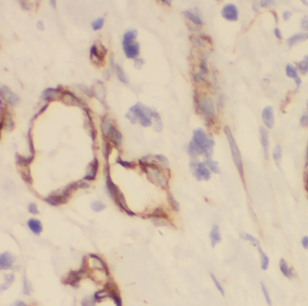 DIRAS1 antibody|DIRAS1抗体