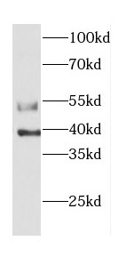 CASP12 antibody|CASP12抗体