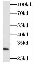 PHYHD1 antibody|PHYHD1抗体