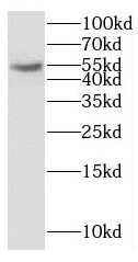 CYP2S1 antibody|CYP2S1抗体 FNab0