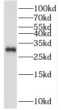 PSME3 antibody|PSME3抗体