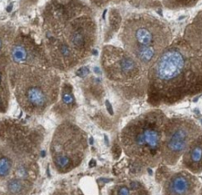 AGMO antibody|AGMO抗体