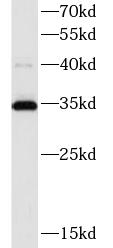 ATP5F1C antibody|ATP5F1C抗体 FNa
