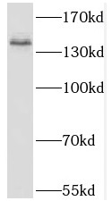 KIT antibody|KIT抗体 FNab09971