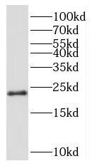 RPL24 antibody|RPL24抗体