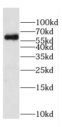 CPNE6 antibody|CPNE6抗体