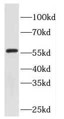 EYA2 antibody|EYA2抗体