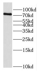 EXOC5 antibody|EXOC5抗体