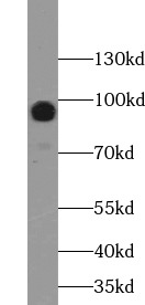 MUC16 antibody|MUC16抗体 FNab054