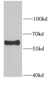 RAD23B antibody|RAD23B抗体