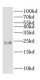 COPS8 antibody|COPS8抗体