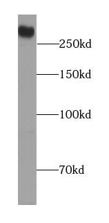 DSP antibody|DSP抗体