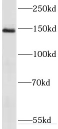 RECQL4 antibody|RECQL4抗体