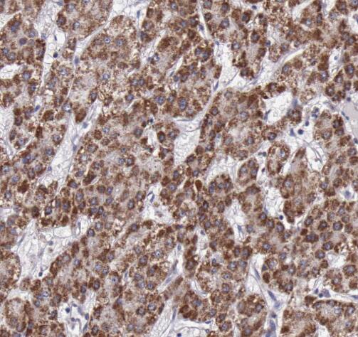 S100A6 antibody|S100A6抗体 FNab0