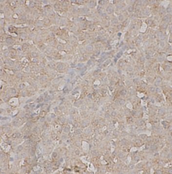 C8A antibody|C8A抗体 FNab10168