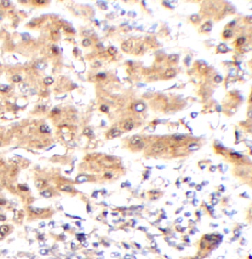 IRF5 antibody|IRF5抗体 FNab10757