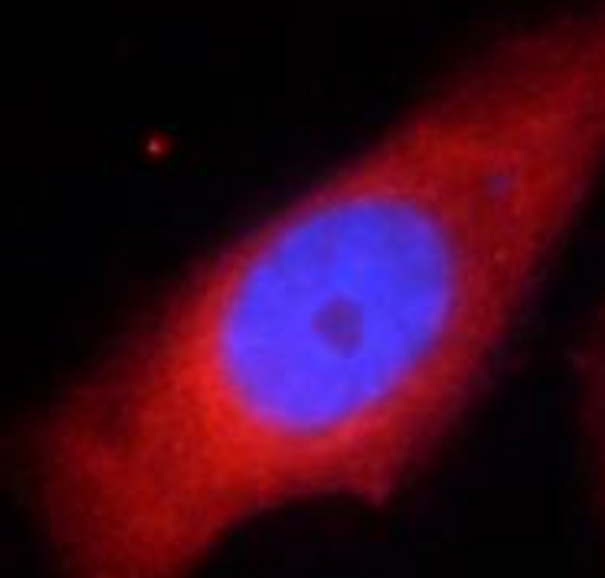 RPS6KB1 antibody|RPS6KB1抗体 FNa