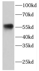 ETV6 antibody|ETV6抗体 FNab02882