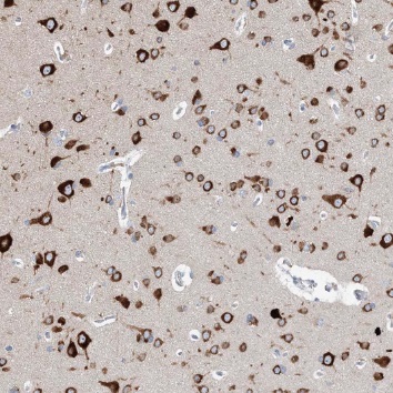 TCEA1 antibody|TCEA1抗体