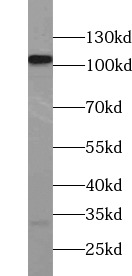 PI4KB antibody|PI4KB抗体