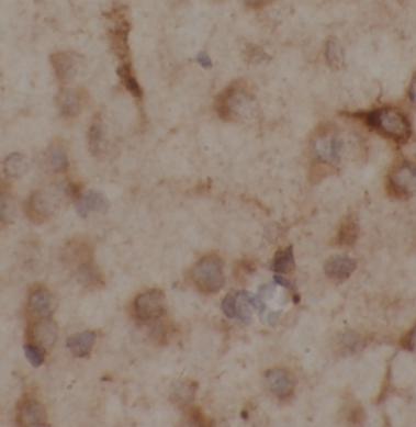 RTN1-C antibody|RTN1-C抗体