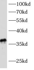 ATPAF1 antibody|ATPAF1抗体 FNab0