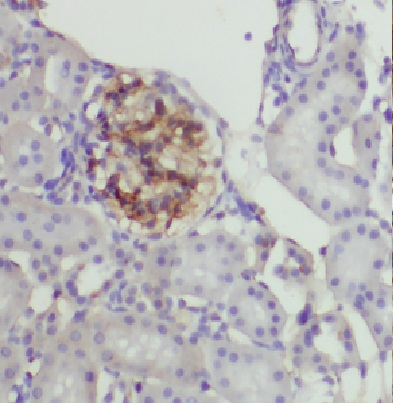 HLA-A antibody|HLA-A抗体 FNab038