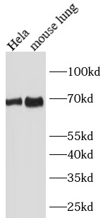 SLC1A5 antibody|SLC1A5抗体