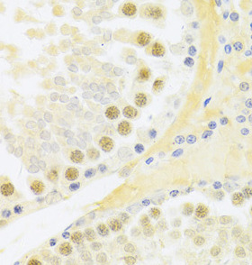 RFC4 antibody|RFC4抗体