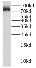 AKAP17A antibody|AKAP17A抗体