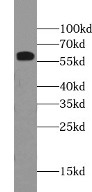 AKT1 antibody|AKT1抗体 FNab00271