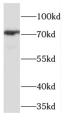 PHF21A antibody|PHF21A抗体