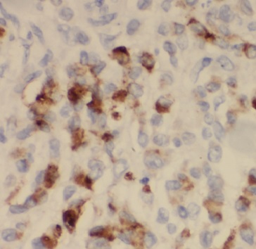 MICAL2 antibody|MICAL2抗体