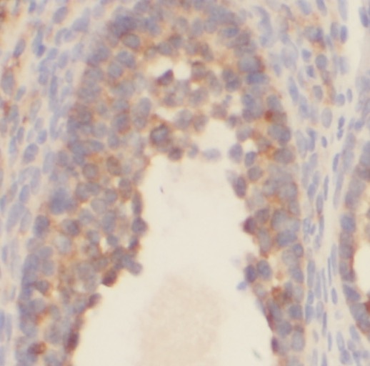 PAPSS1 antibody|PAPSS1抗体