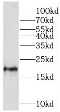 TMEM35A antibody|TMEM35A抗体