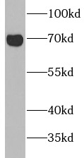 CAVIN2 antibody|CAVIN2抗体
