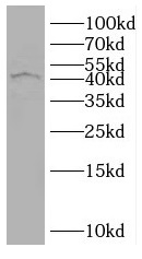 RUNDC3B antibody|RUNDC3B抗体