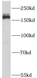 THBS1 antibody|THBS1抗体
