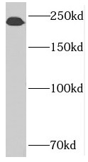SUPT6H antibody|SUPT6H抗体 FNab0