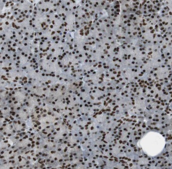 ENC1 antibody|ENC1抗体