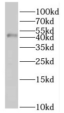 SERPINA5 antibody|SERPINA5抗体 F