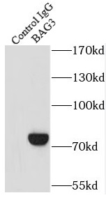 AP1B1 antibody|AP1B1抗体
