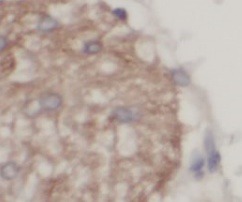 UCP1 antibody|UCP1抗体