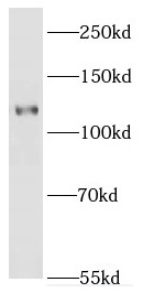 EPHA8 antibody|EPHA8抗体