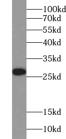 TXNDC9 antibody|TXNDC9抗体